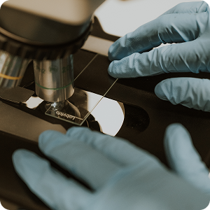 Post Vasectomy Sperm Analysis Post Vasectomy Sperm Analysis